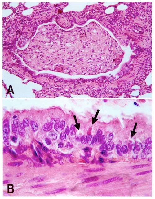 African Wild Dog Infected Lung Tissue Showing Viral Protrusions