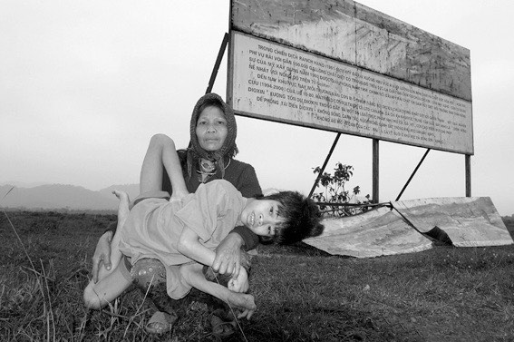 Mother Holding Son Affected by Agent Orange Causing Physical and Mental Handicaps