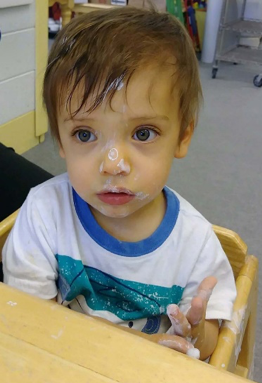 Small child with paste on nose
