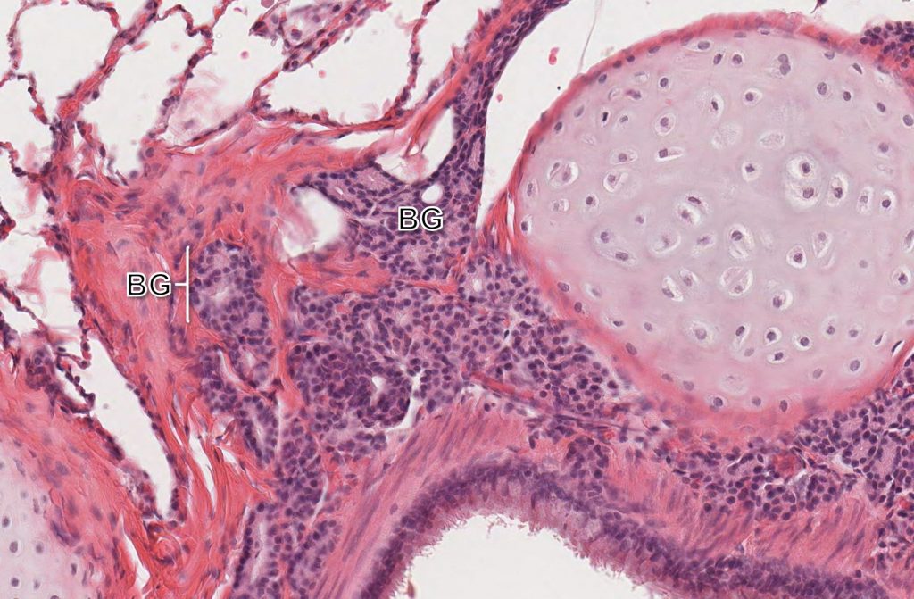 bronchus slide labelled