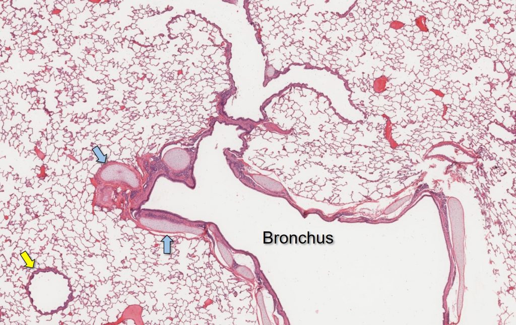 bronchus vs bronchiole histology