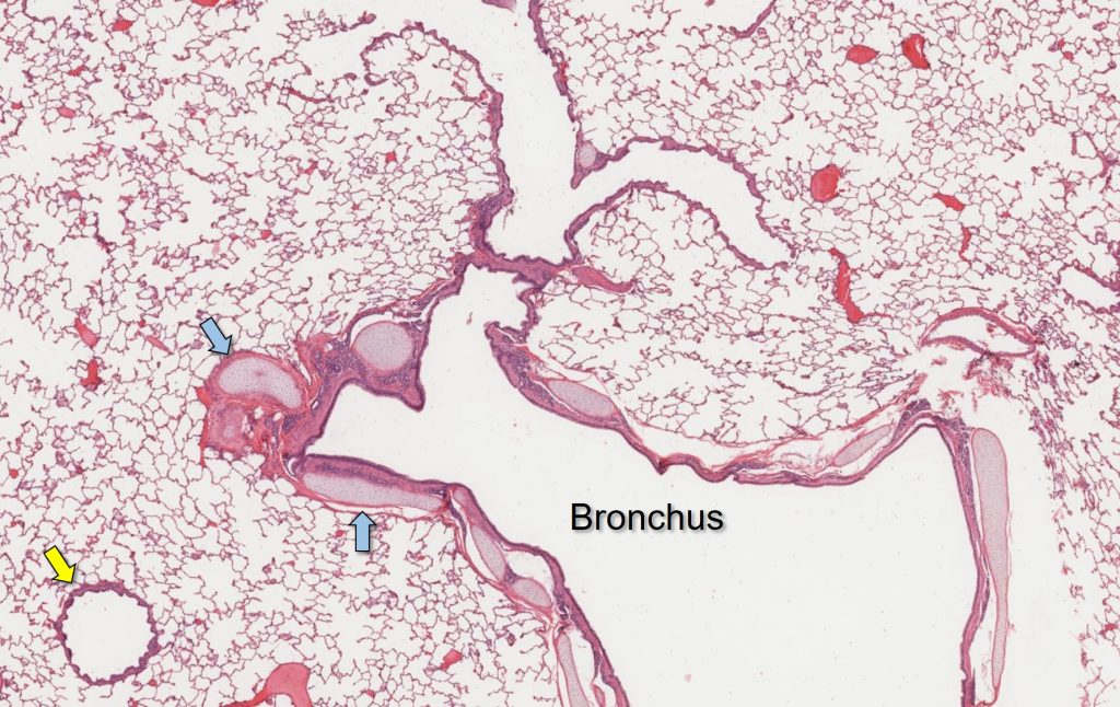 bronchus and bronchiole