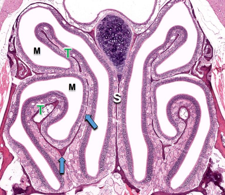 air-conduction-nasal-cavity-paranasal-sinuses-and-vomeronasal-organ