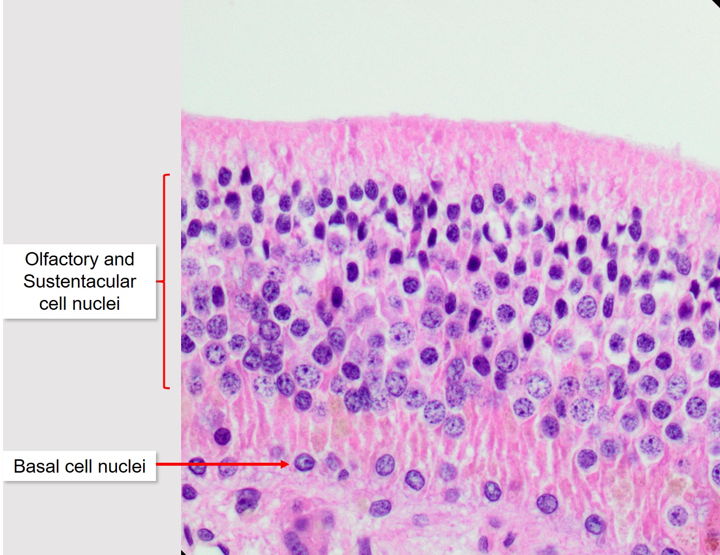 Air conduction: Nasal cavity, Paranasal sinuses, and Vomeronasal Organ ...