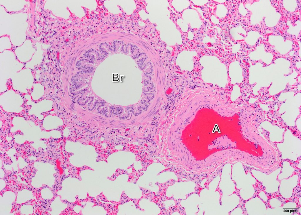 bronchus slide labelled