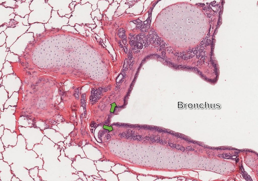 bronchus slide labelled