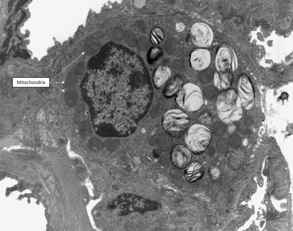 mitochondria in a cell