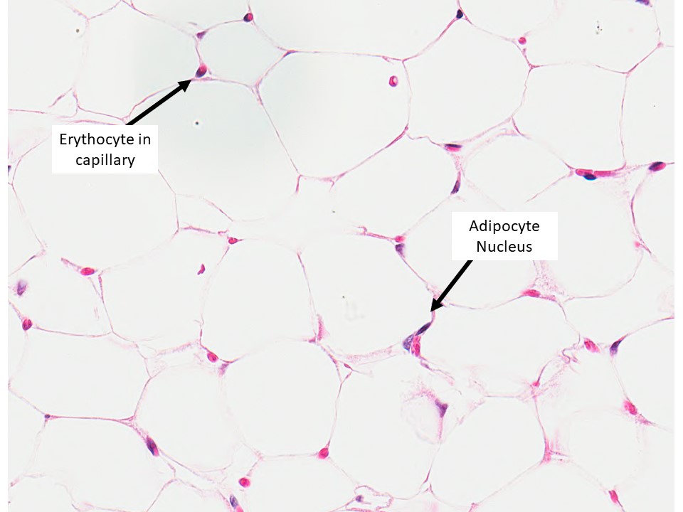 brown adipose connective tissue