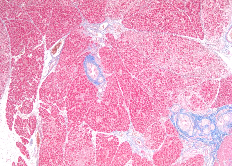 pancreas gland histology labeled