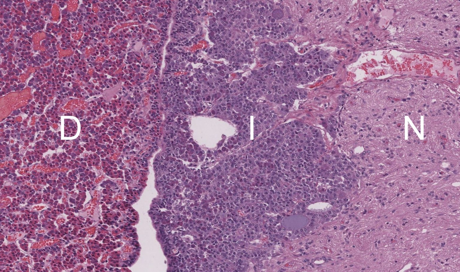 Anterior Pituitary Histology