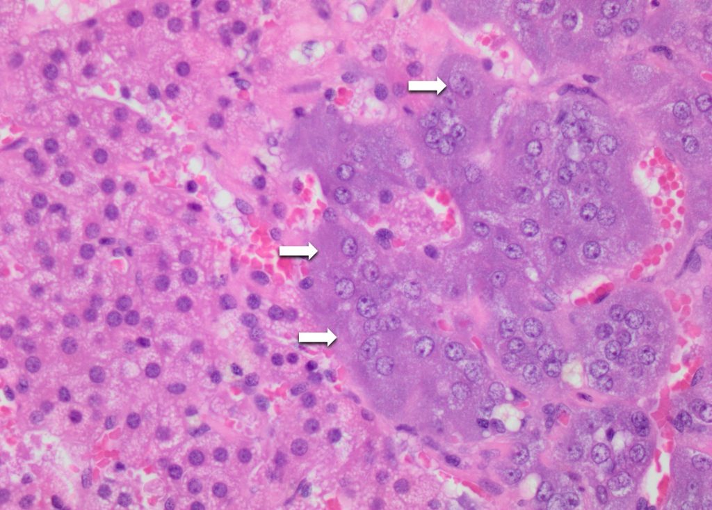 chromaffin cells histology