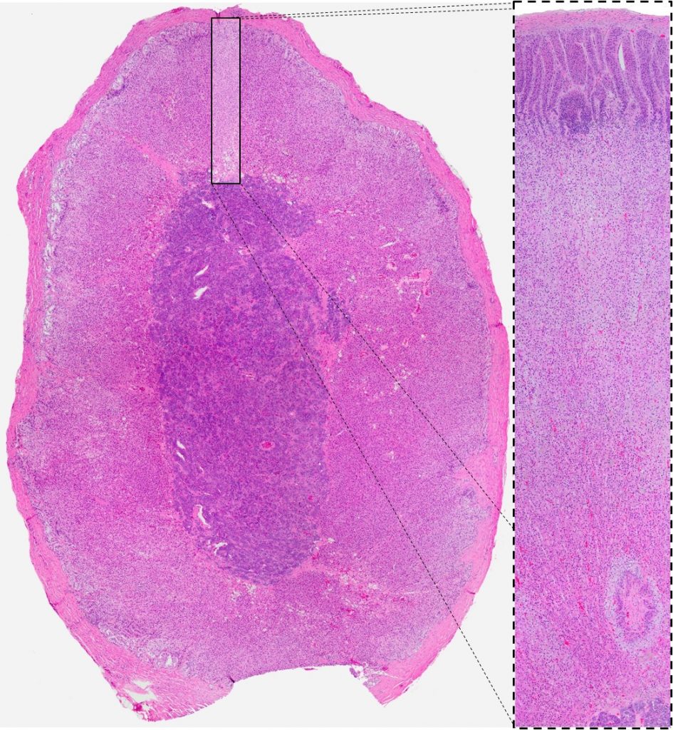 adrenal cortex location