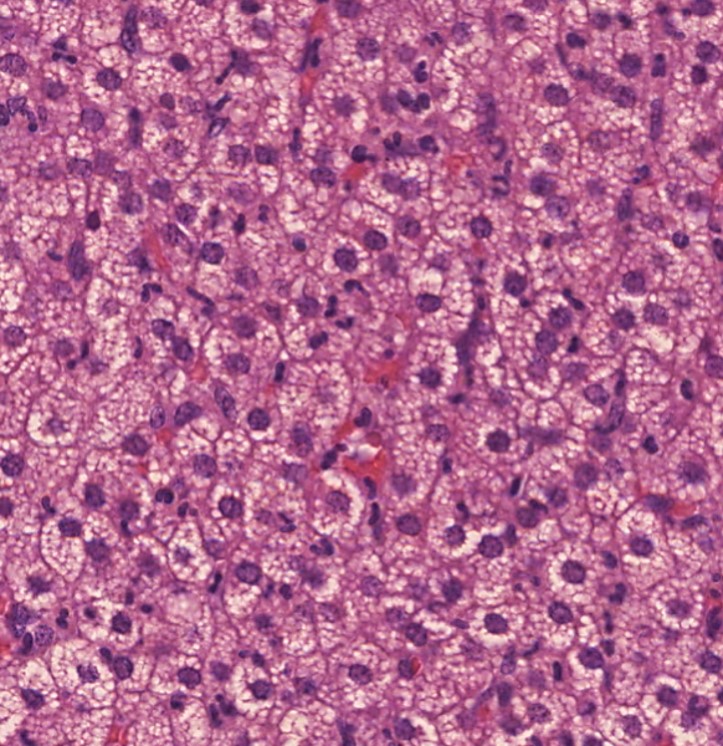 chromaffin cells histology