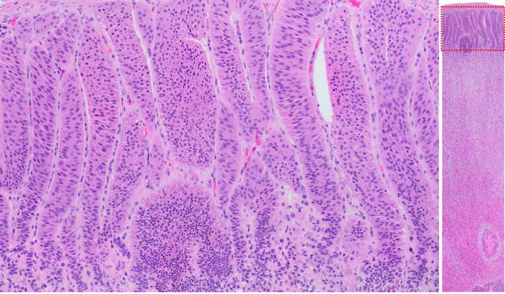 adrenal histology