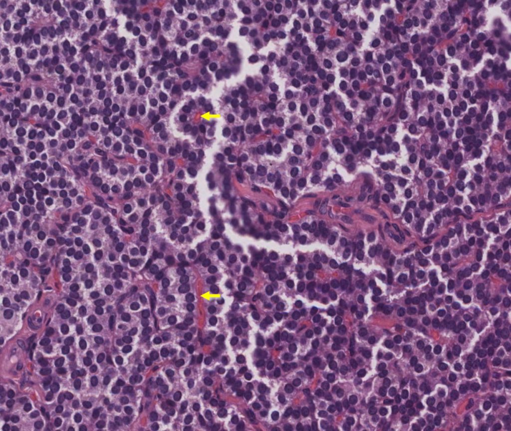 parathyroid gland histology