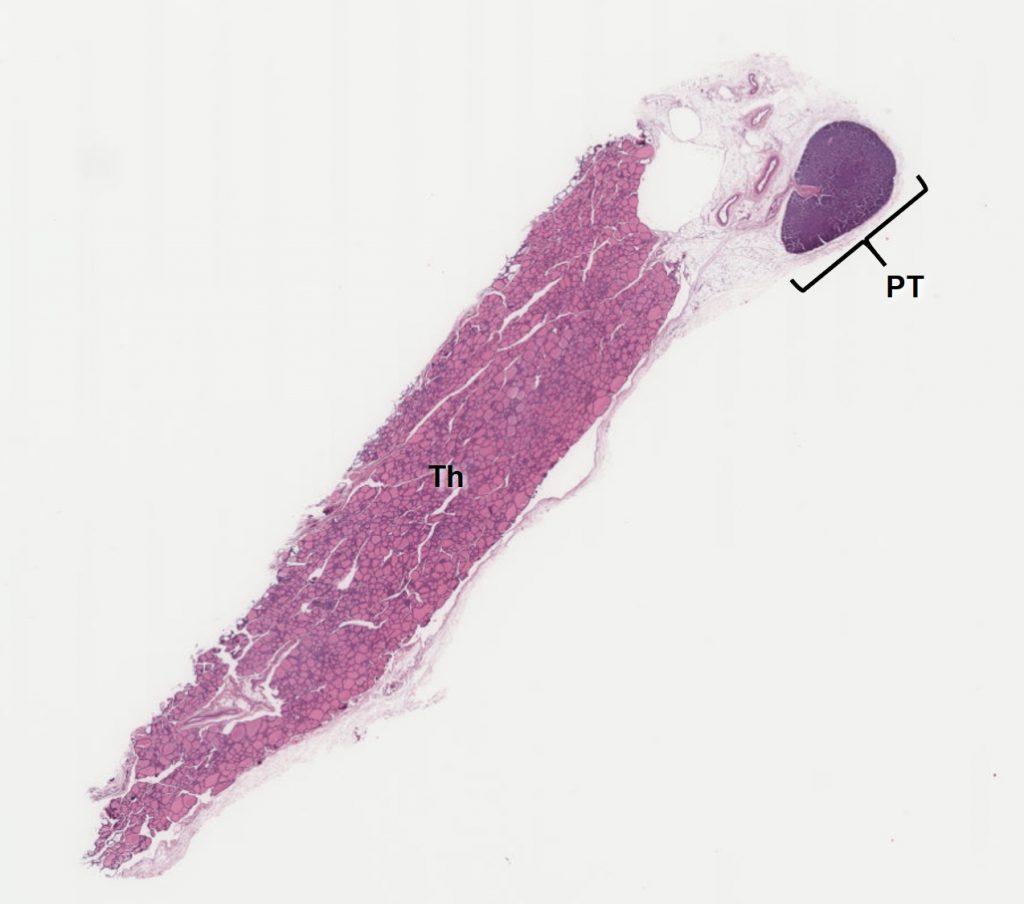 parathyroid gland histology