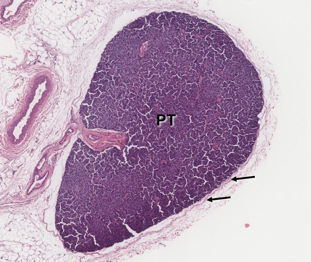 parathyroid gland histology