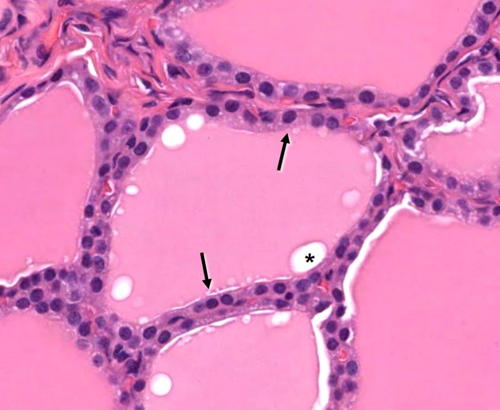 Thyroid Gland Veterinary Histology