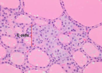 Thyroid gland – Veterinary Histology