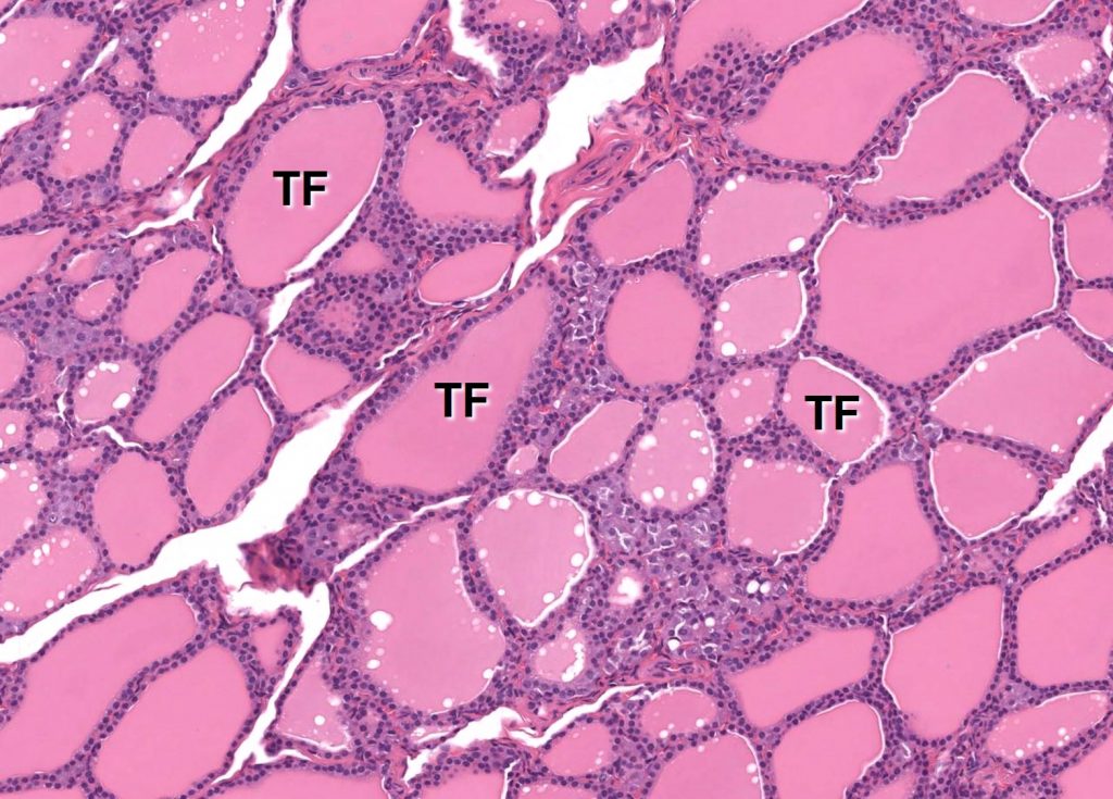 follicular colloid of thyroid