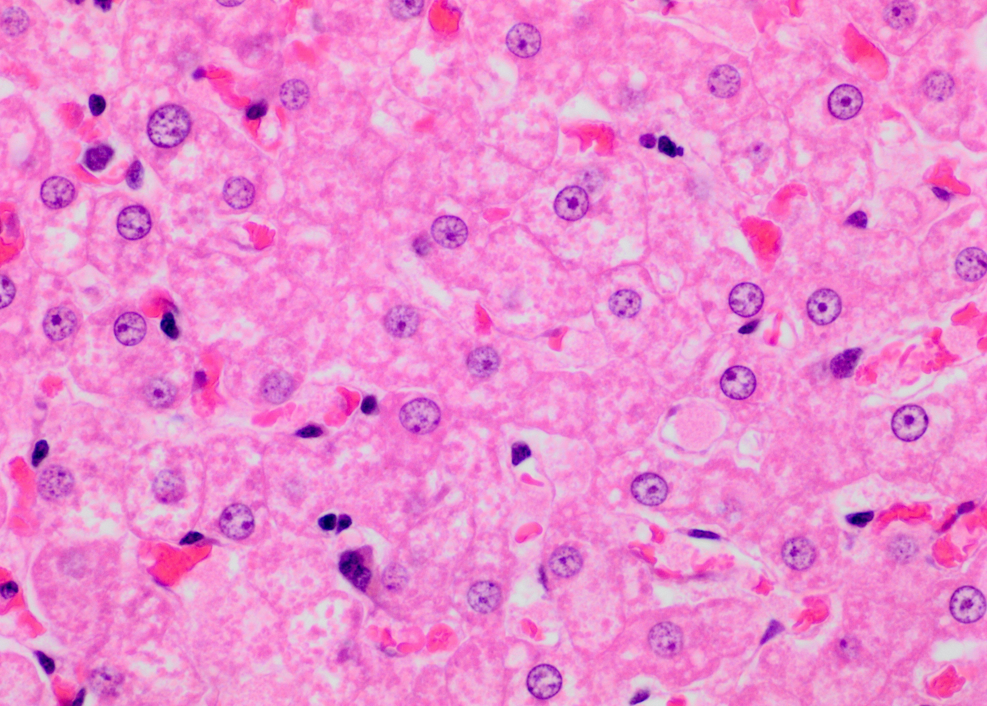 hepatocyte histology