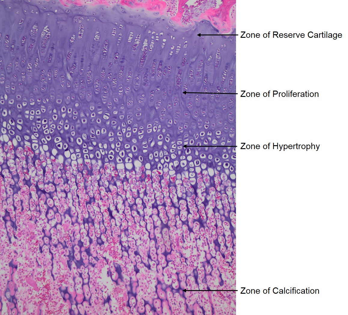 endochondral ossification histology