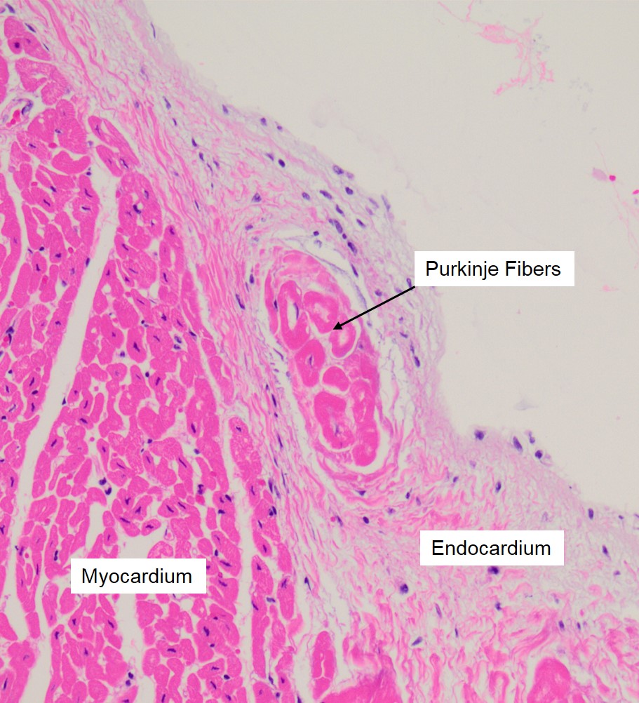 purkinje fibers histology